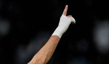 Dedo y mano de benzema